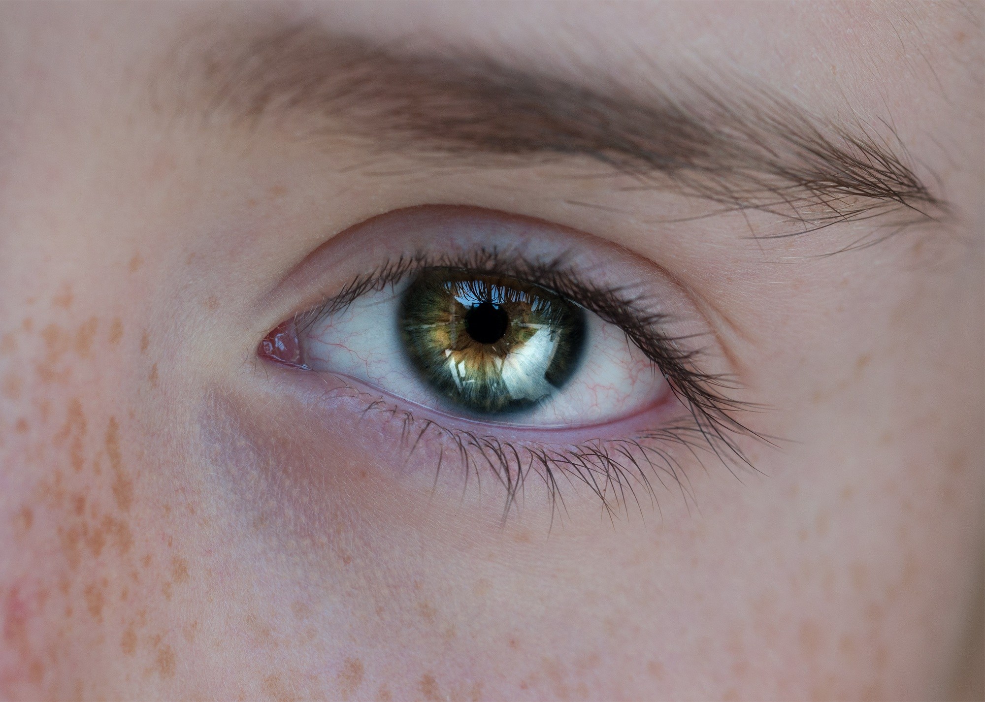 eye-1109851-1
