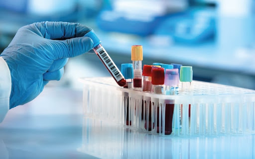 blood test lab