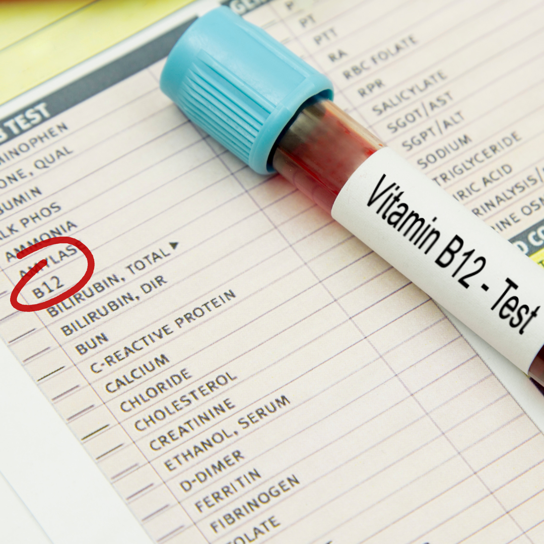 Testing For Vitamin B12 Deficiency | MEDitSIMPLE Blog