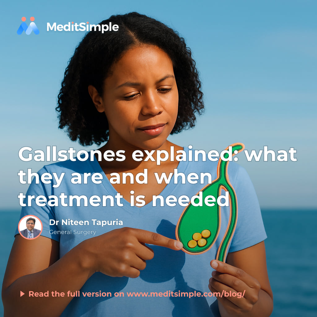 Illustration showing the location of gallstone pain in the upper right abdomen
